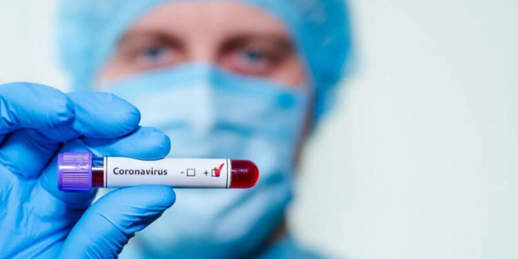 AKTUALNO: Veljavni ukrepi v R. Avstriji zaradi Korona virusa